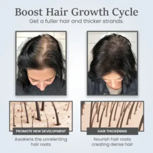 Alternative view of ThickTress Hair Growth Spray
