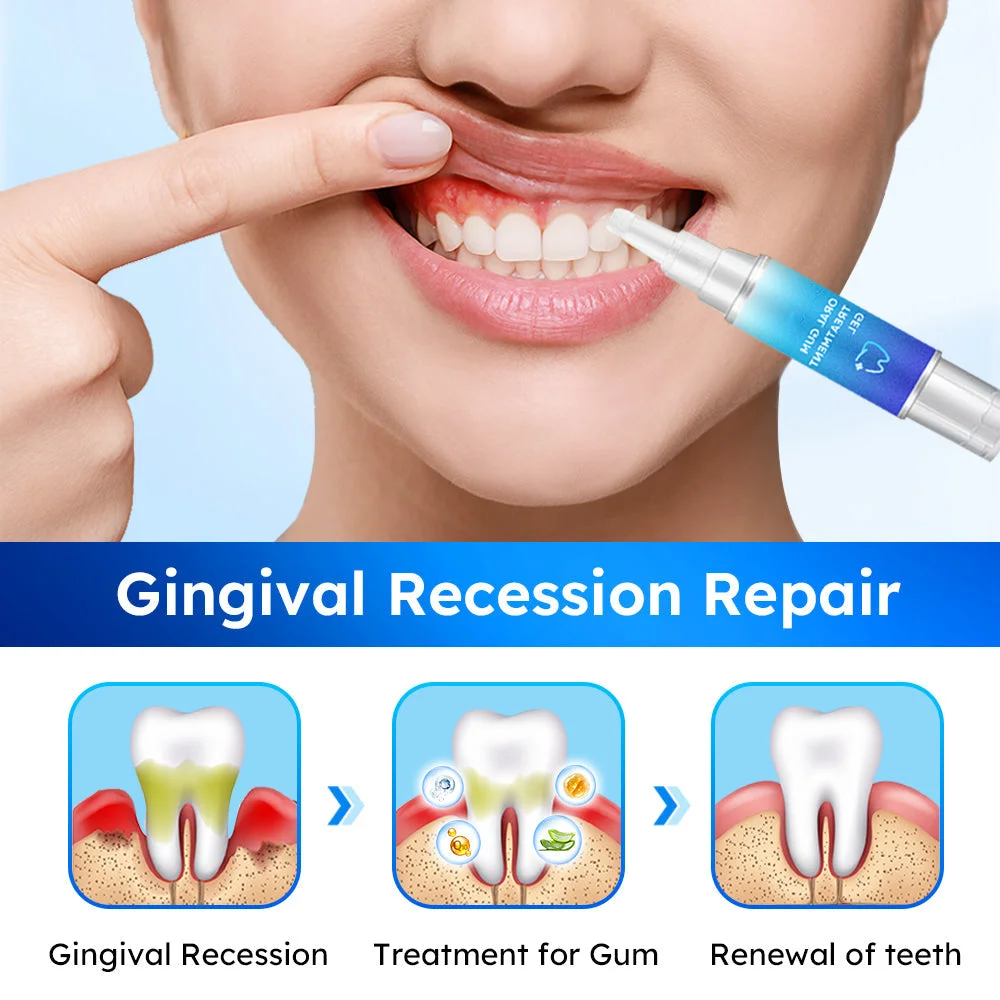 Oral Gum Treatment Gel - Image 5