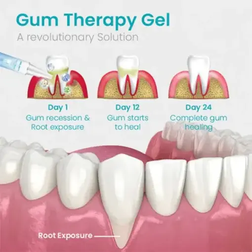 Gum Shield Therapy Gel - Image 5