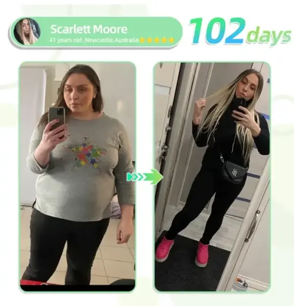 Nano Microneedle Patch