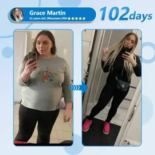 Nano Microneedle Slim & Firm Patch with Collagen Peptides - Image 3