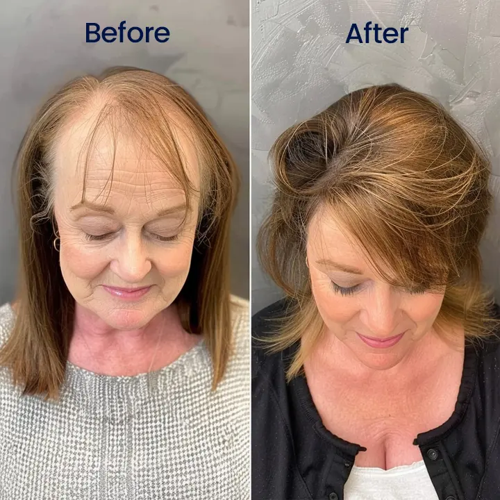 Maximum Strength 5% Minoxidil Fast-Action Hair Growth Serum - Image 4