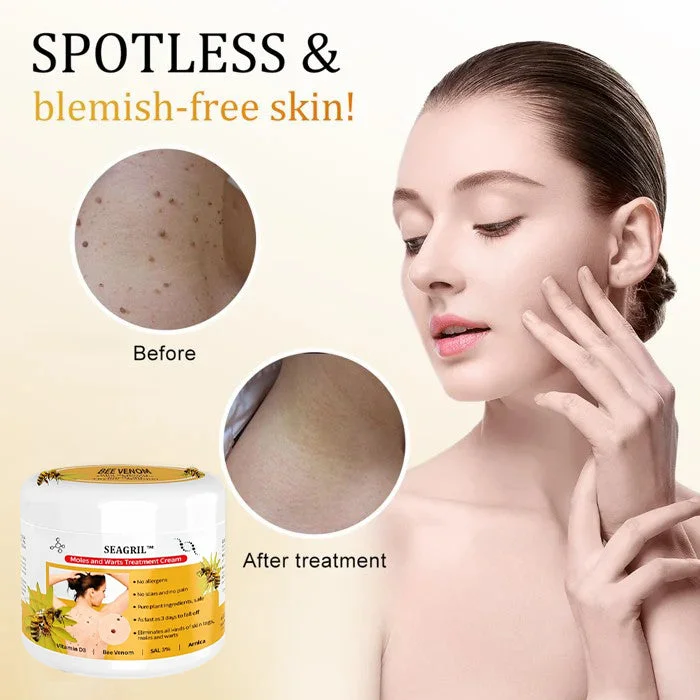 Bee Venom Mole and Wart Treatment Cream - Image 4