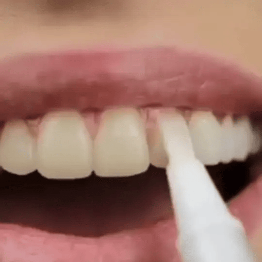 Teeth Whitening Pen - Image 2
