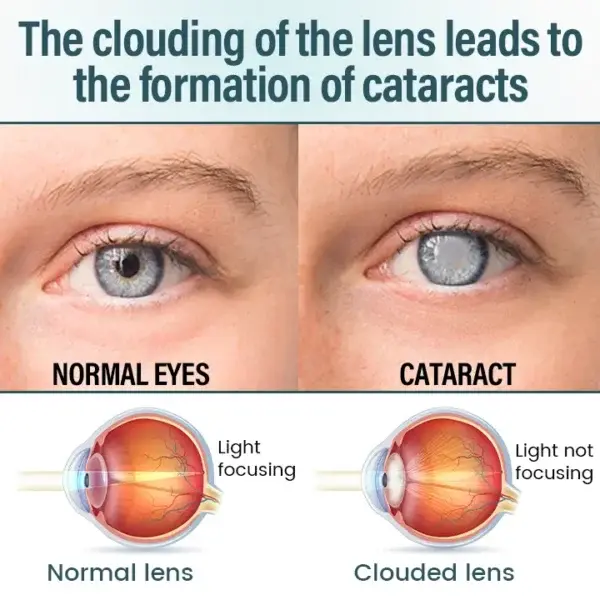 OptiFusion Nano Eye Drops Serum - Image 5