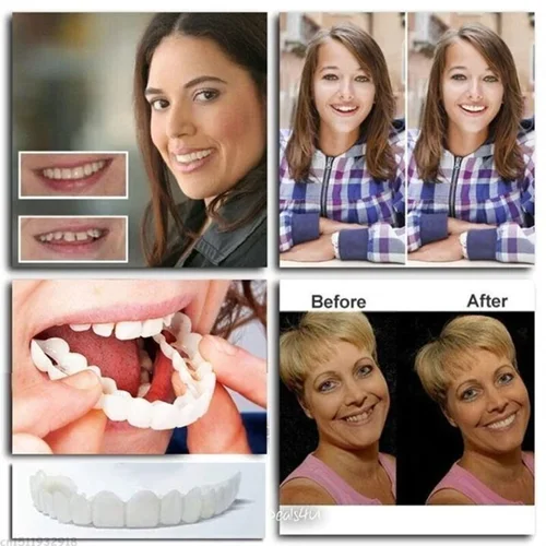 Adjustable Snap-On Dentures - Image 4