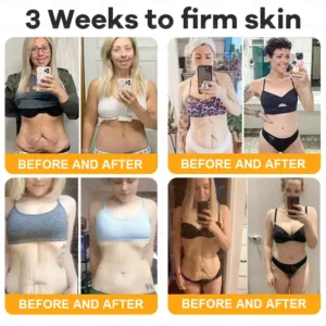 Alternative view of Bee Venom Skin Restoration Cream LAST DAY 80% OFF