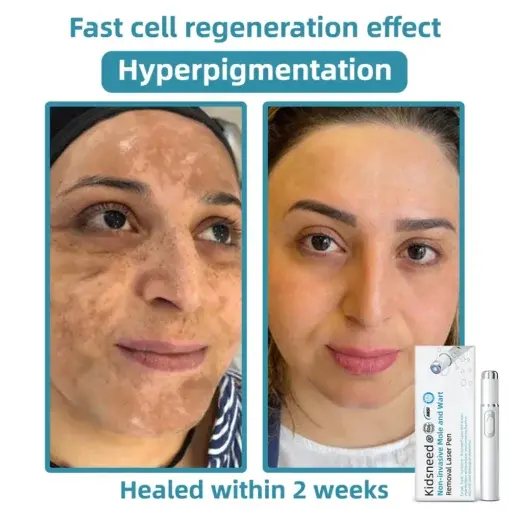 ๐ตon-i๐va๐๐ve ๐ดo๐e an๐
๐พar๐ ๐นemo๐๐๐ ๐ณase๐ ๐ทen - Image 11