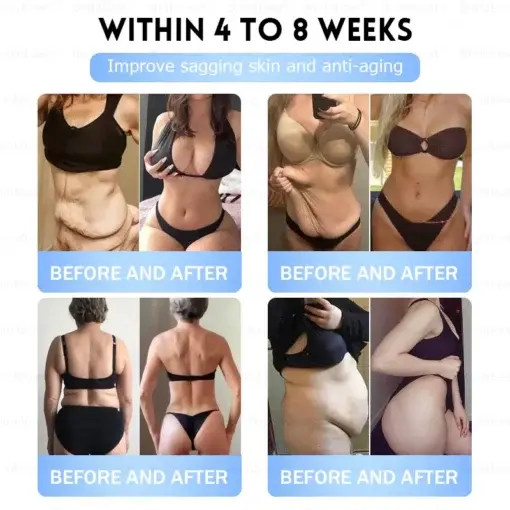 Slim & Firm đano đicroneedle đatch - Image 12