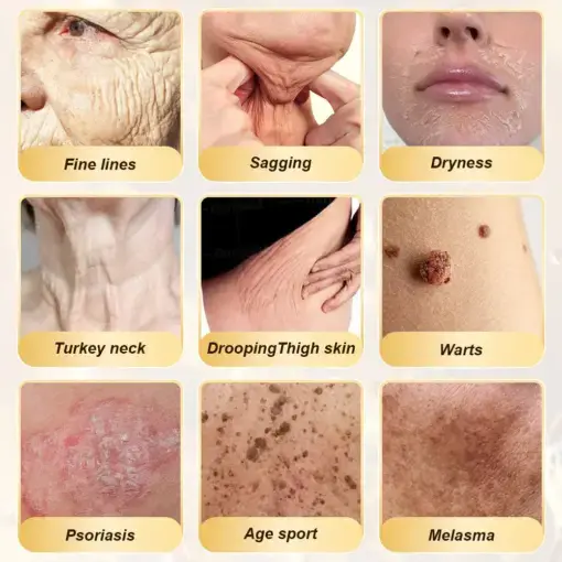 ð©ðð ðœðððð ðºððð ð¹ððððð & ðšððð-ðšðððð ðªðððð - Image 2