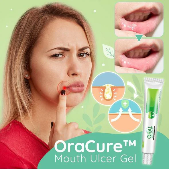 Mouth Ulcer Gel - Image 2