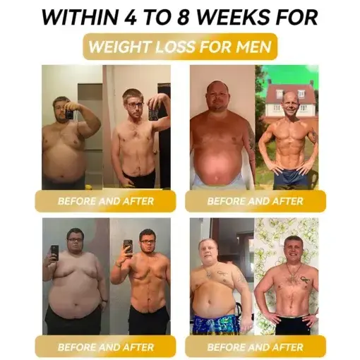 ๐๐๐ ๐ง๐๐ญ๐ข๐ ๐๐ง๐๐ซ๐ ๐ฒ ๐๐-๐๐ญ๐จ๐ง๐ ๐๐๐ฉ๐ฅ๐ ๐๐๐ซ๐ซ๐ข๐ง๐ ๐ฌ - Image 4