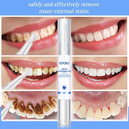 Magical Teeth Whitening Pen - Image 3