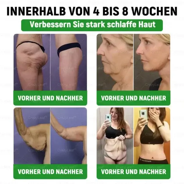 6-๐๐-1 ๐ฏ๐๐๐๐๐ ๐บ๐๐๐๐๐๐๐ ๐ฎ๐๐บ๐
๐๐ข๐ช๐ฎ๐ข๐ - Image 5