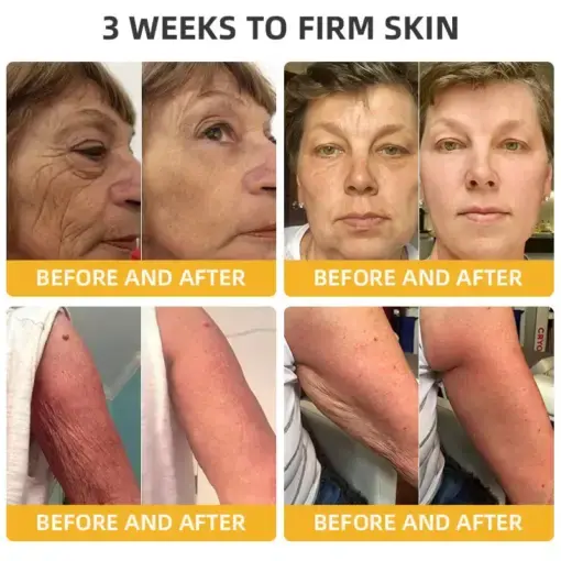 ๐๐๐๐ ๐๐๐+ ๐๐๐ ๐๐ง๐๐ซ๐๐ญ๐ข๐ฏ๐ ๐๐๐ฉ๐๐ข๐ซ ๐๐จ๐ญ๐ข๐จ๐ง - Image 4