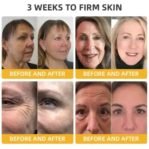 ๐๐๐๐ ๐๐๐+ ๐๐๐ ๐๐ง๐๐ซ๐๐ญ๐ข๐ฏ๐ ๐๐๐ฉ๐๐ข๐ซ ๐๐จ๐ญ๐ข๐จ๐ง - Image 5