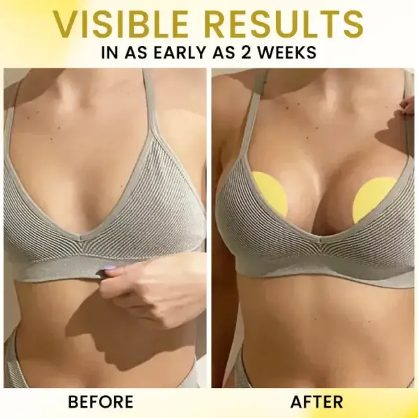 Apex-Lift Volumizing & Lifting Microneedle Bust Patch - Image 4