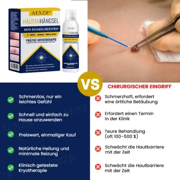 Hautanhängsel-Kryo-Behandlungsspray - Image 2