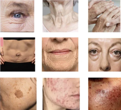 Advanced Collagen Boost Lifting Anti-Aging Serum - Image 7