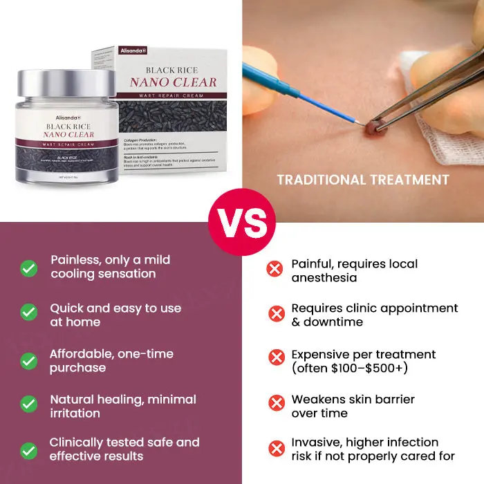 BlackRice Wart Repair Cream - Image 2