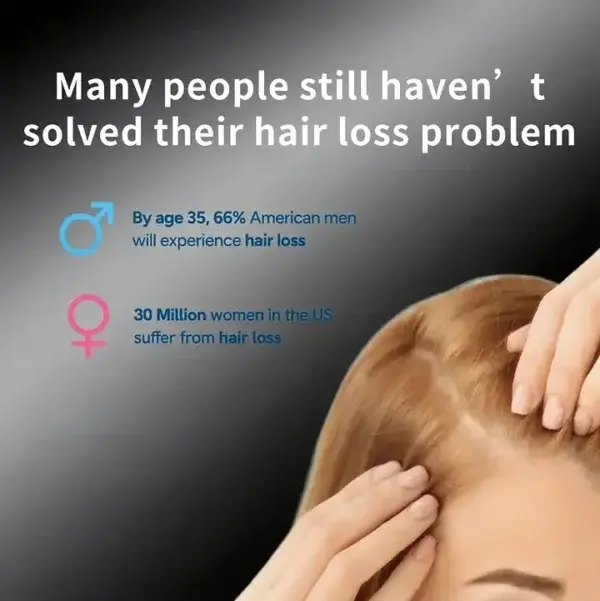 Professional Anti-Hair Loss Roll-On – Stimulates Hair Growth in 1–2 Weeks - Image 4