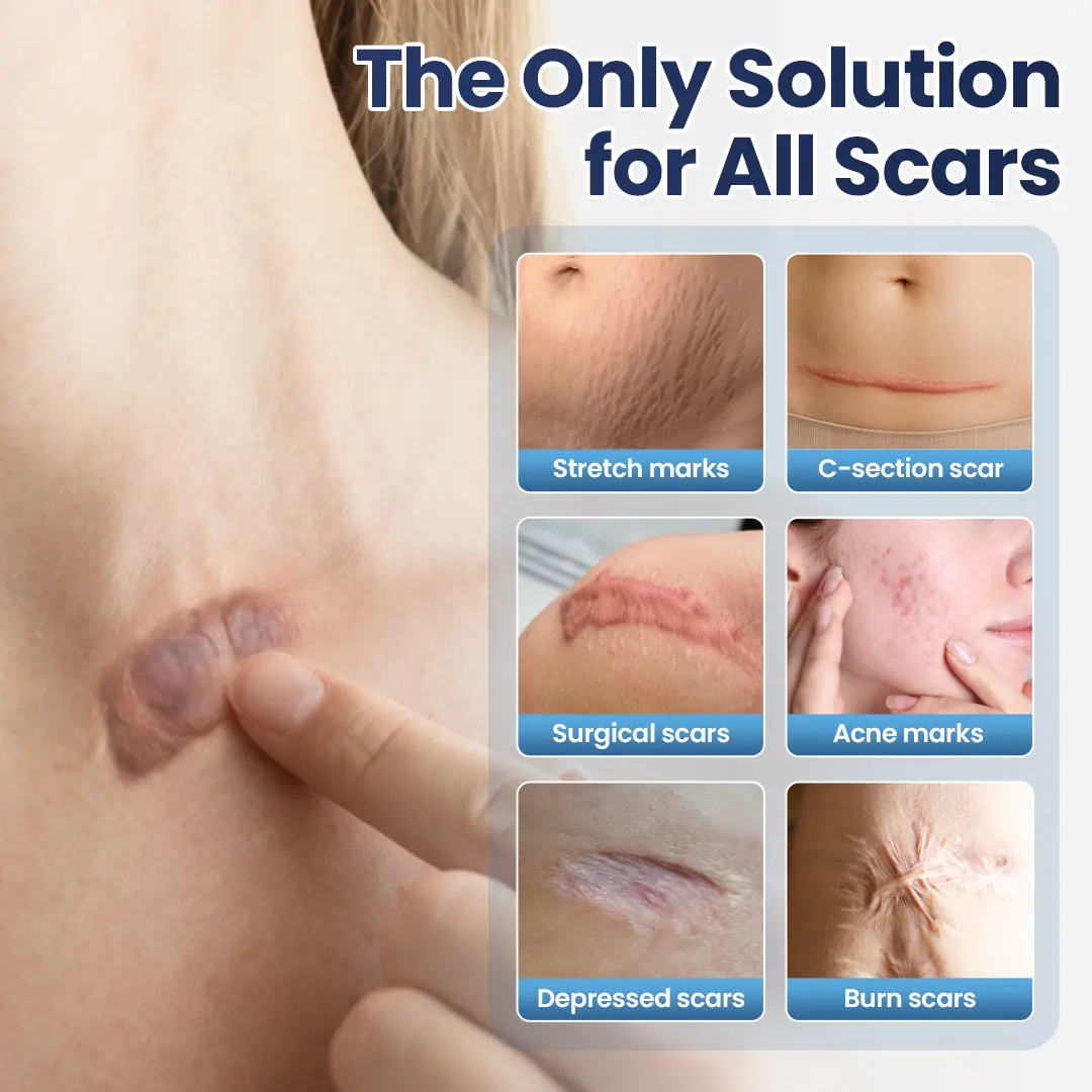 DermaFix Texture Repair Gel - Image 4