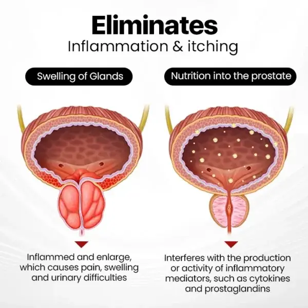 ProstaAir Dual-Function Nasal Inhaler - Image 3