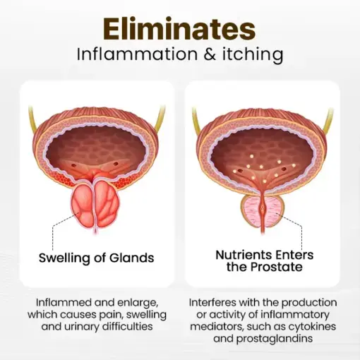 ProstaVibe Rapid Relief Male Vitality Inhaler - Image 4