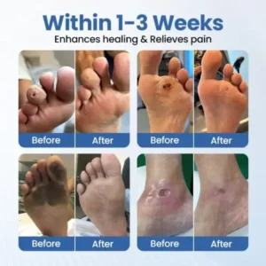 Alternative view of VenHeal Bee Venom Diabetic Wound Spray