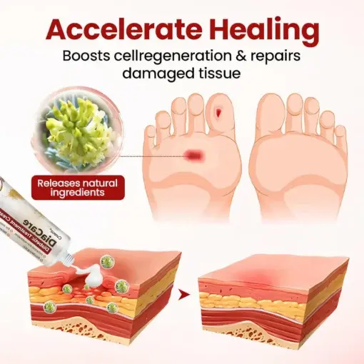 DiaCare Diabetic Treatment Cream - Image 4