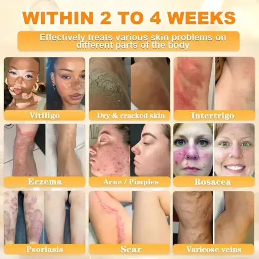 Bee Venom Skin Restoration Cream - Image 4