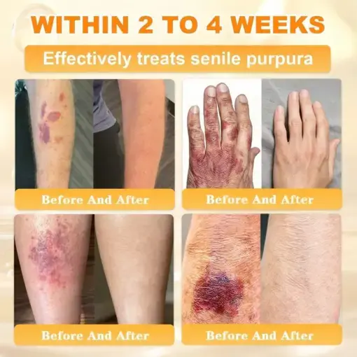 Bee Venom Skin Restoration Cream - Image 7