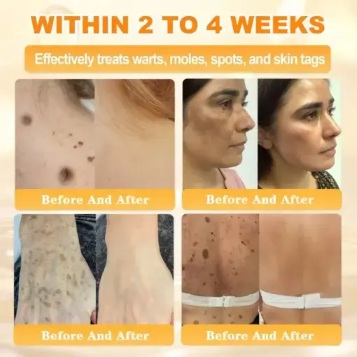 Bee Venom Skin Restoration Cream - Image 8