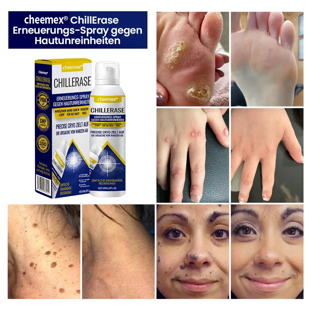 ChillErase Erneuerungs-Spray gegen Hautunreinheiten - Image 2
