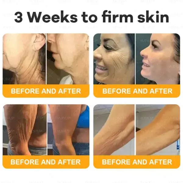 Bee Venom Skin Restoration Cream - Image 5