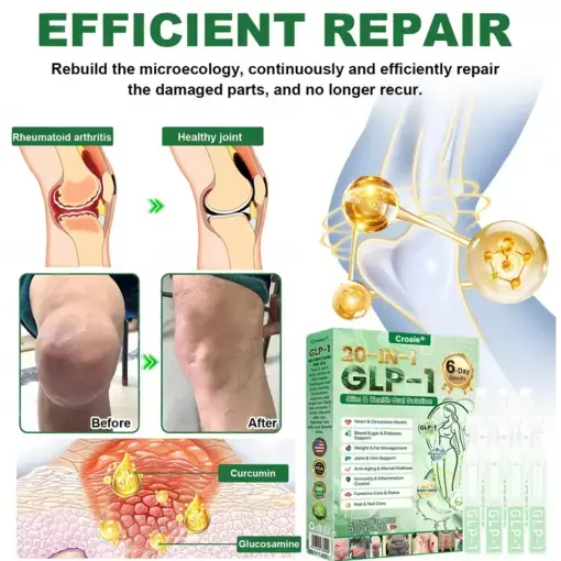 ๐๐-๐ข๐ง-๐ ๐๐ฅ๐ข๐ฆ & ๐๐๐๐ฅ๐ญ๐ก ๐๐ซ๐๐ฅ ๐๐จ๐ฅ๐ฎ๐ญ๐ข๐จ๐ง - Image 24