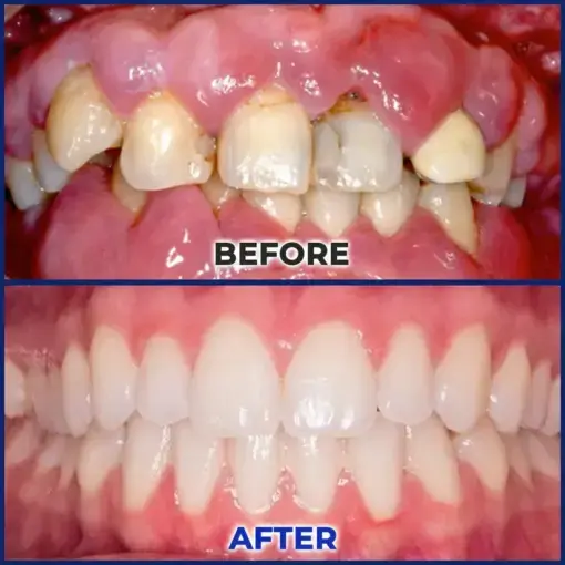 ApiGuard BeeVenom Therapeutic Oral Drops & Rinse - Image 3