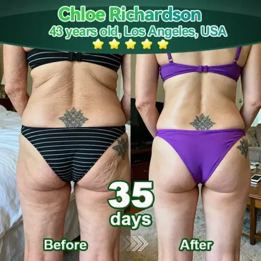 𝑆𝑡𝑒𝑚 𝐶𝑒𝑙𝑙 & 𝐶𝑜𝑙𝑙𝑎𝑔𝑒𝑛 𝑃𝑒𝑝𝑡𝑖𝑑𝑒 𝑂𝑟𝑎𝑙 𝐷𝑟𝑜𝑝𝑠 - Image 4