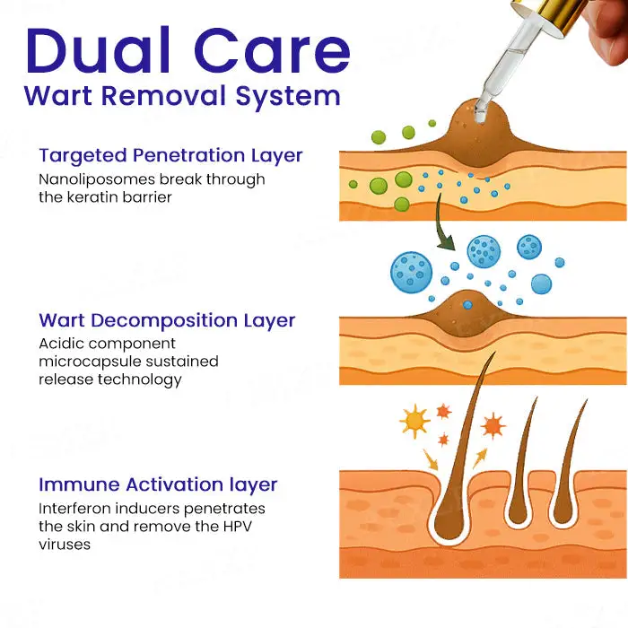 HPV Genital Warts Remover Drop - Image 4