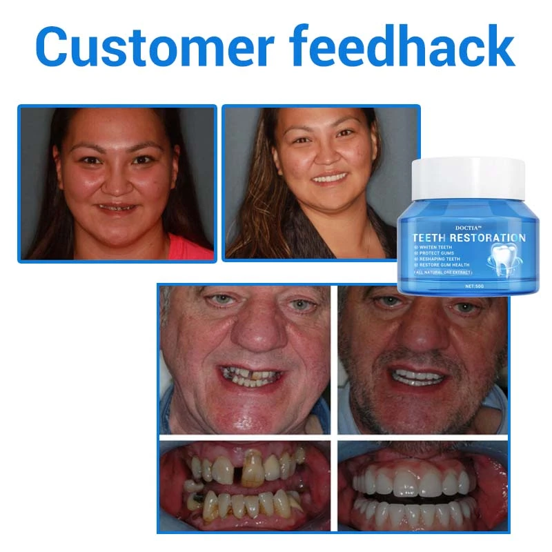 Teeth Restoration Mineral Powder - Image 23