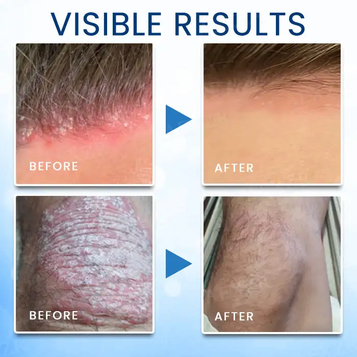 Magnesium Herbal Skin Spray - Image 4