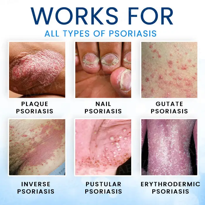 Magnesium Herbal Skin Spray - Image 5