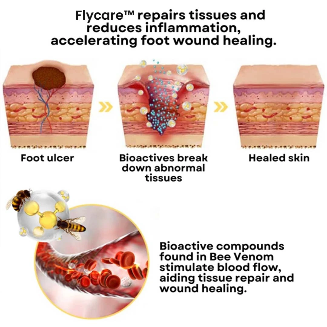 BeeVenom Diabetic Foot Treatment Spray - Image 2