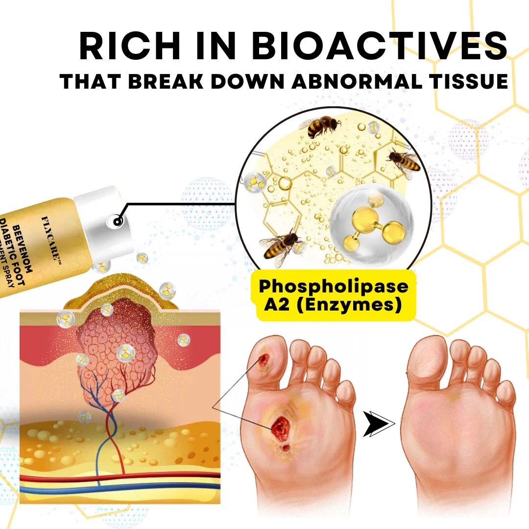 BeeVenom Diabetic Foot Treatment Spray - Image 4