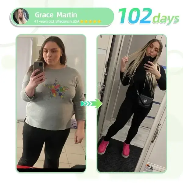 GIP+ 𝖭𝖺𝗇𝗈 𝖬𝗂𝖼𝗋𝗈𝗇𝖾𝖾𝖽𝗅𝖾 𝖯𝖺𝗍𝖼𝗁 - Image 4