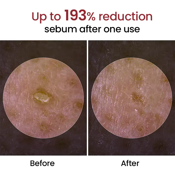 Peel Show Glow Black Rice Ampoule - Image 5