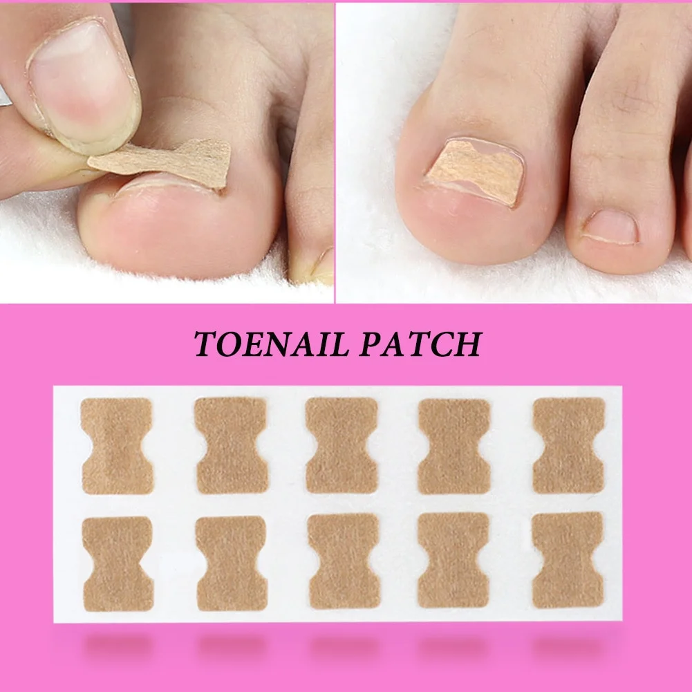 Glue Free Toenail Patch - Image 2