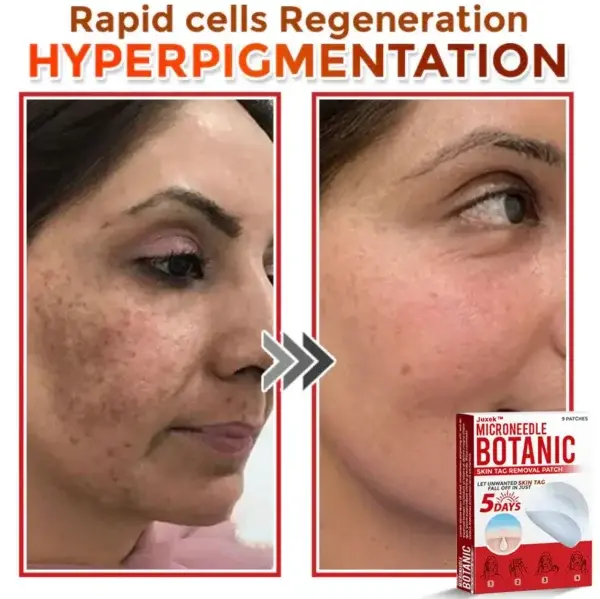 Removal Patch - Image 7