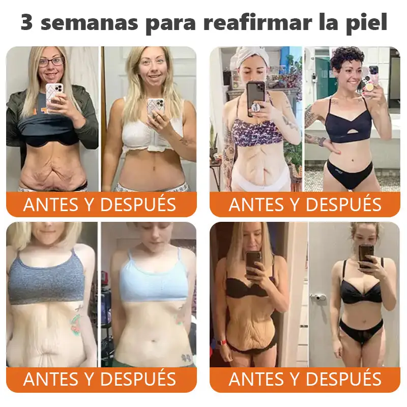 barra de esencia reafirmante con botox y veneno de abeja - Image 2