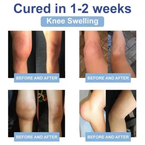 Black Rice Pain Healing Bone Cream - Image 10